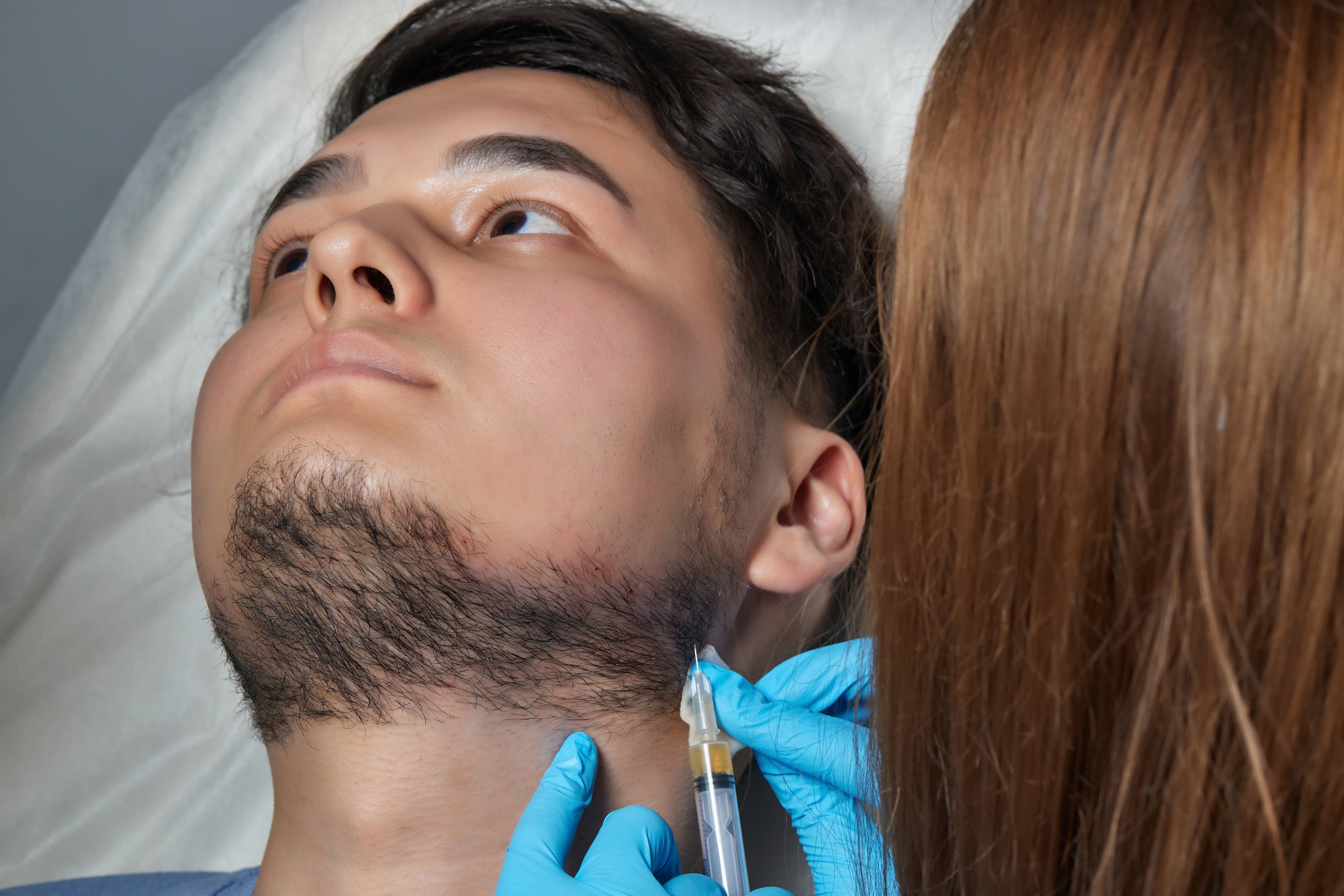 Beard Transplant (Facial Hair Restoration)